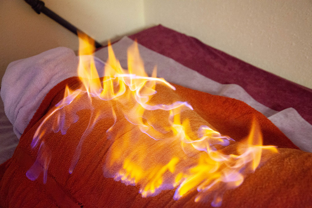 Hausarzt Arnsberg – Stoll – Leistungen – Tibetische Feuermassage Hausarzt Arnsberg - Stoll - Leistungen - Tibetische Feuermassage